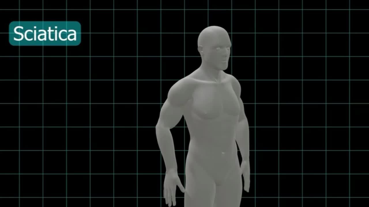 1pc Back Brace for Lower Back with Pulley System,Lumbar Support Belt for Men & Women with Lumbar Pad, Ergonomic Design and Soft Breathable 3D Knit Material for Work, Heavy Lifting - La Tienda Bella